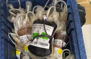 Health: The shortage of pouches paralyzes blood transfusions
